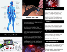 Load image into Gallery viewer, PHS60: 60w Class 4 Laser - Portland Health Supply