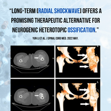 Load image into Gallery viewer, PHS RADIAL SHOCKWAVE

